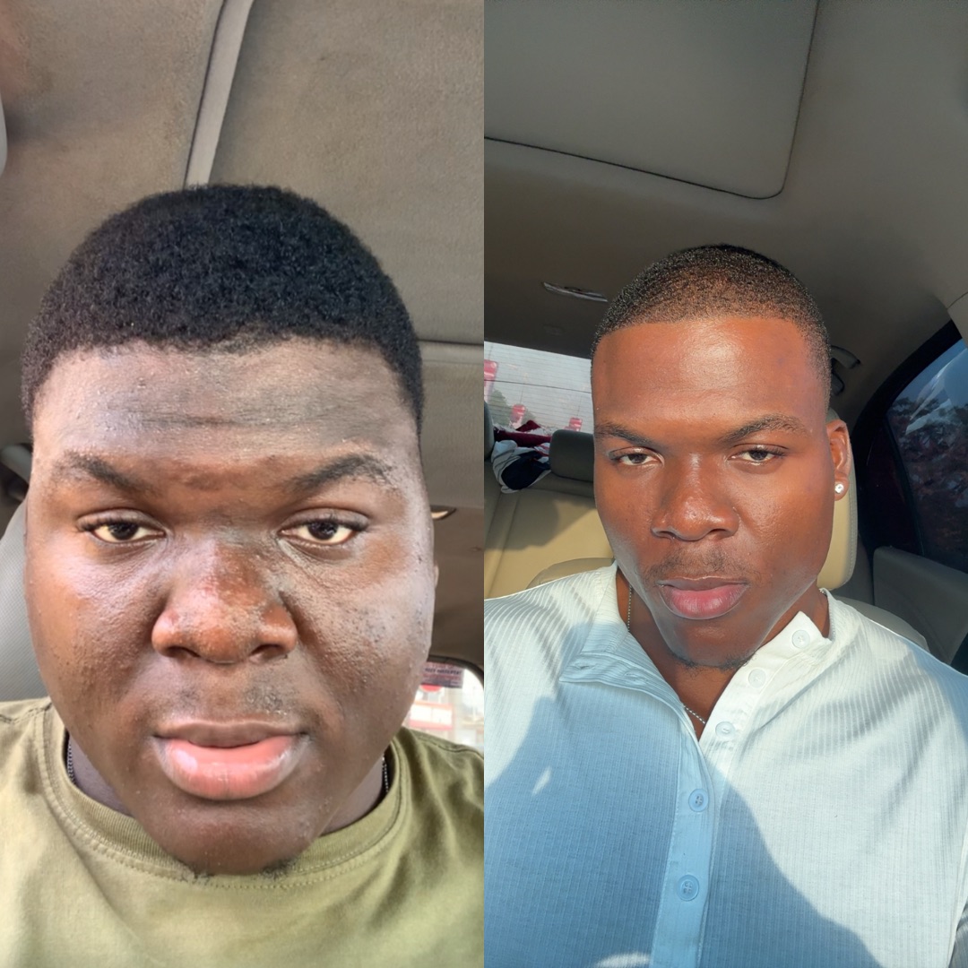 Clinton face transformation